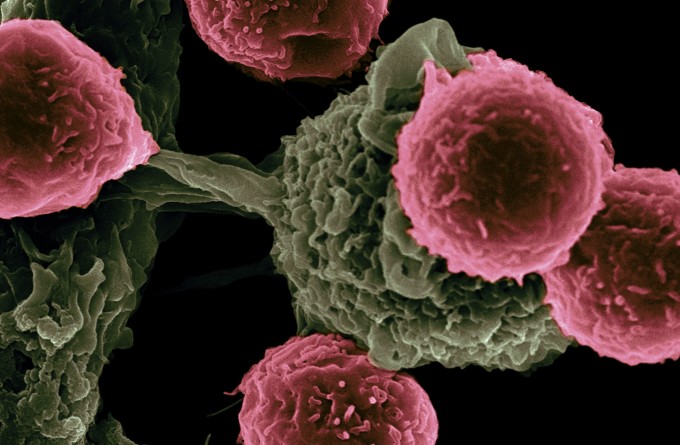 New study opens doors for immunotherapies for prostate cancer