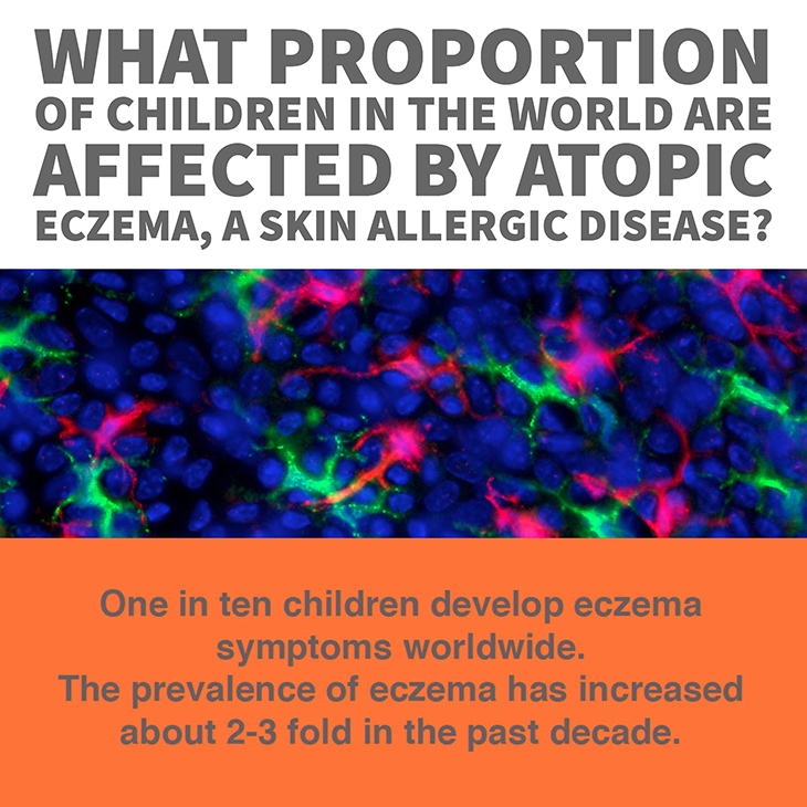 MIMR atopic eczema skin allergy 01